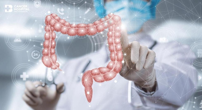 سرطان-القولون2